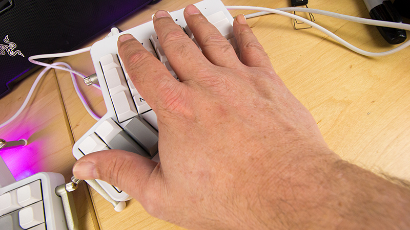 You can read an excellent history of the ErgoDox keyboard over at Trauring.org.